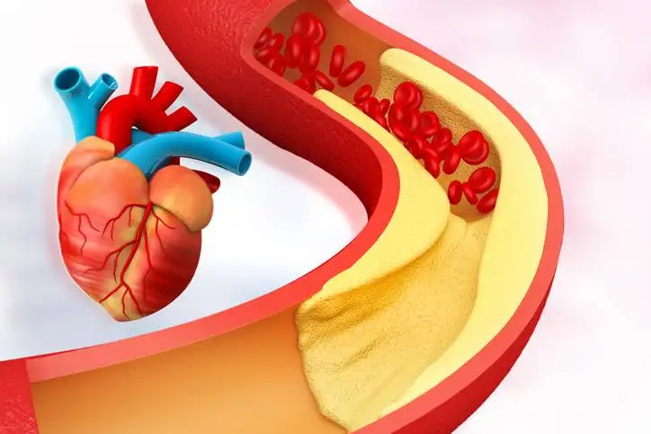 ChatGPT Certainly! Here's an alternative text (alt text) description for an image related to "Comprehensive Guide to Lowering Cholesterol: Effective Strategies for Heart Health": "An illustrative image depicting a variety of heart-healthy foods such as fruits, vegetables, whole grains, nuts, and fish. The image conveys the concept of a comprehensive guide to lowering cholesterol through diet and healthy lifestyle choices, promoting heart health and overall well-being."