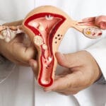 A comprehensive guide on uterine fibroids, covering their causes, symptoms, types, diagnosis, and treatment options. The document explains factors contributing to fibroid development, common symptoms, medical and surgical treatments, and alternative therapies. It also discusses diagnostic methods such as ultrasound, MRI, and hysteroscopy, helping individuals understand and manage fibroids effectively." Let me know if you need any modifications!